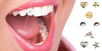 Zubni nakit
