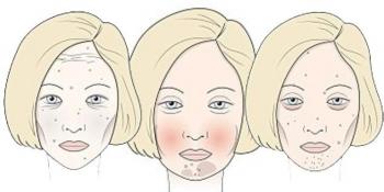 Koje je od njih vaše lice - šteti li vam šećer, vino ili gluten?