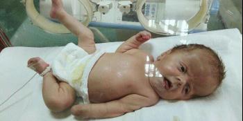 Pomozimo Vanji Jovanoviću, bebi kojoj je dijagnostikovan Apertov sindrom