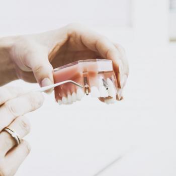 Zubni implanti: Šta sve možete očekivati u postopetativnom periodu?
