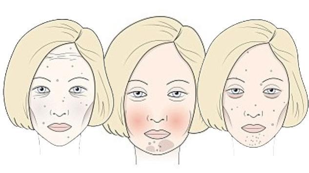 Koje je od njih vaše lice - šteti li vam šećer, vino ili gluten?