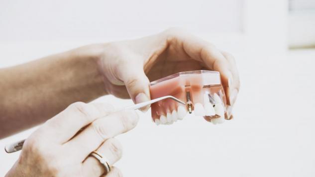 Zubni implanti: Šta sve možete očekivati u postopetativnom periodu?